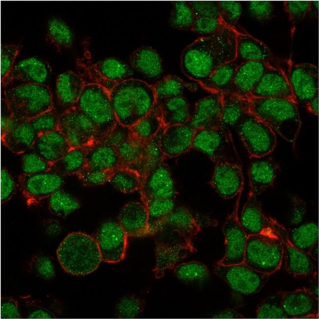 SUMO-1 Antibody in Immunocytochemistry (ICC/IF)