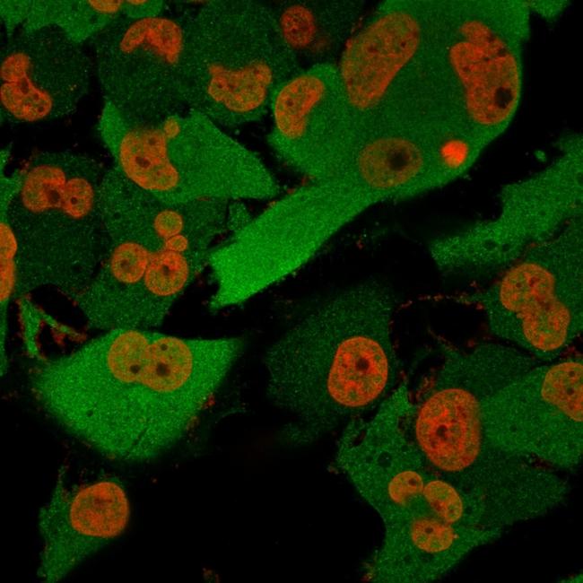 PGP9.5/UchL1 Antibody in Immunocytochemistry (ICC/IF)