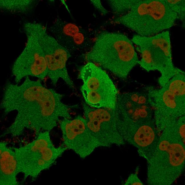 PGP9.5/UchL1 Antibody in Immunocytochemistry (ICC/IF)