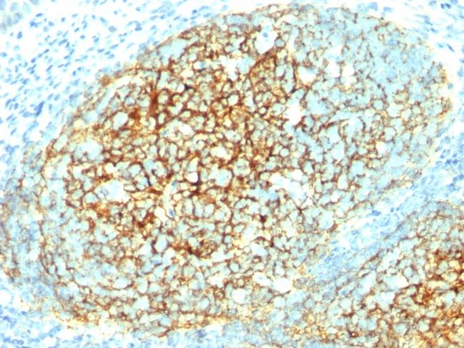 CD106/VCAM1 (Activated Endothelial Cell Marker) Antibody in Immunohistochemistry (Paraffin) (IHC (P))