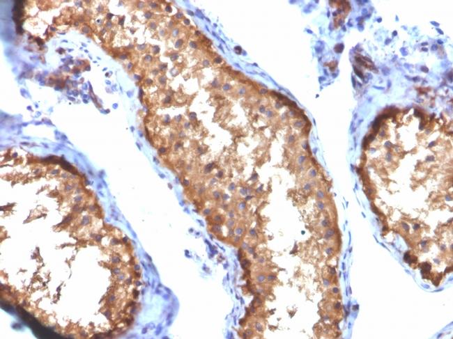 Vinculin Antibody in Immunohistochemistry (Paraffin) (IHC (P))