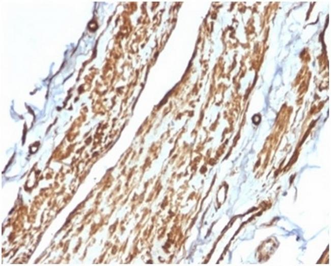 Vinculin (Marker of Age-related Macular Degeneration) Antibody in Immunohistochemistry (Paraffin) (IHC (P))