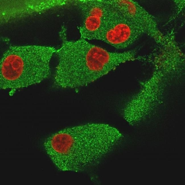 Vinculin Antibody in Immunocytochemistry (ICC/IF)