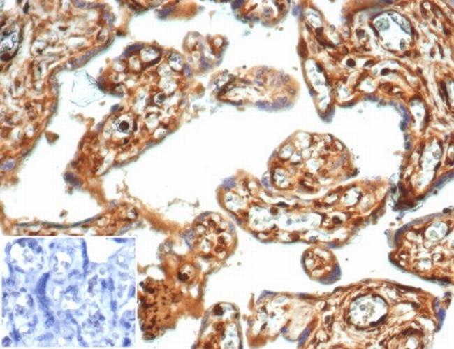 Vinculin (Marker of Age-related Macular Degeneration) Antibody in Immunohistochemistry (Paraffin) (IHC (P))