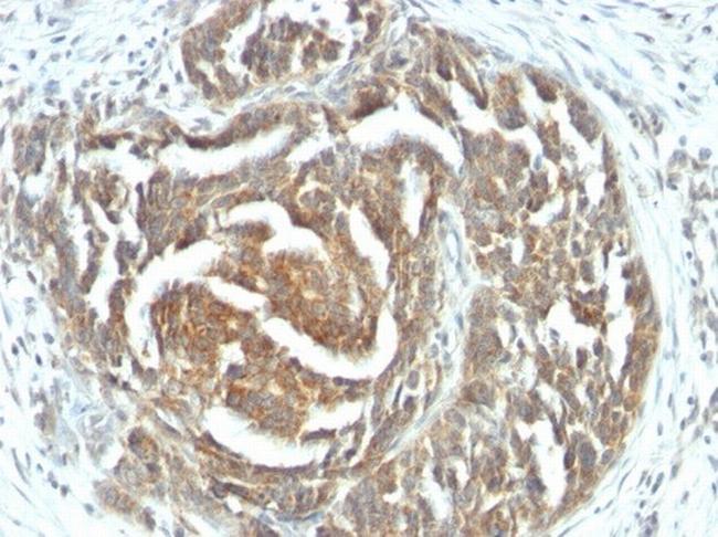 VEGF (Vascular Endothelial Growth Factor) Antibody in Immunohistochemistry (Paraffin) (IHC (P))