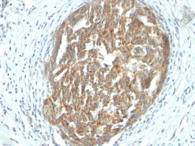 VEGF (Vascular Endothelial Growth Factor) Antibody in Immunohistochemistry (Paraffin) (IHC (P))