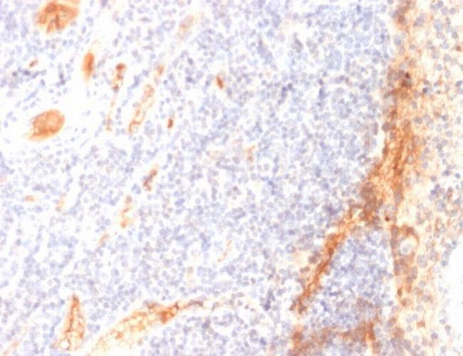 VEGF (Vascular Endothelial Growth Factor) Antibody in Immunohistochemistry (Paraffin) (IHC (P))