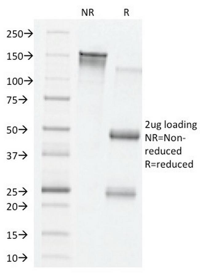 VEGF (Vascular Endothelial Growth Factor) Antibody in SDS-PAGE (SDS-PAGE)