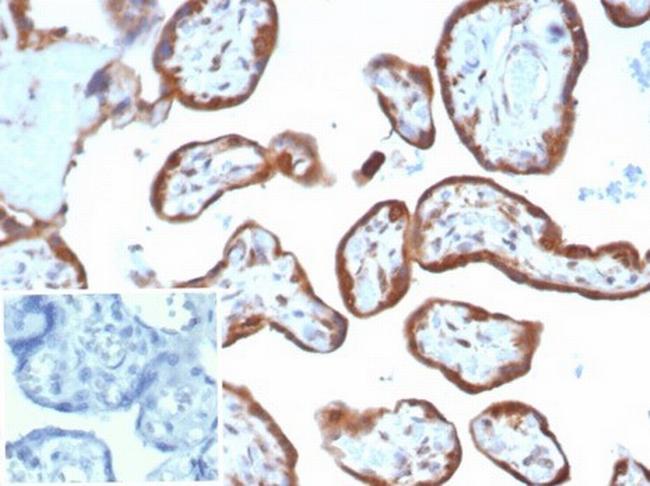 VEGF (Vascular Endothelial Growth Factor) Antibody in Immunohistochemistry (Paraffin) (IHC (P))