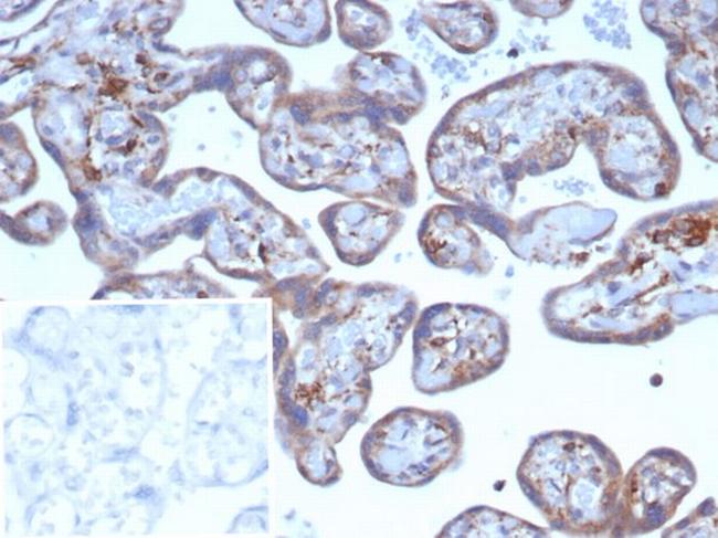 VEGF (Vascular Endothelial Growth Factor) Antibody in Immunohistochemistry (Paraffin) (IHC (P))