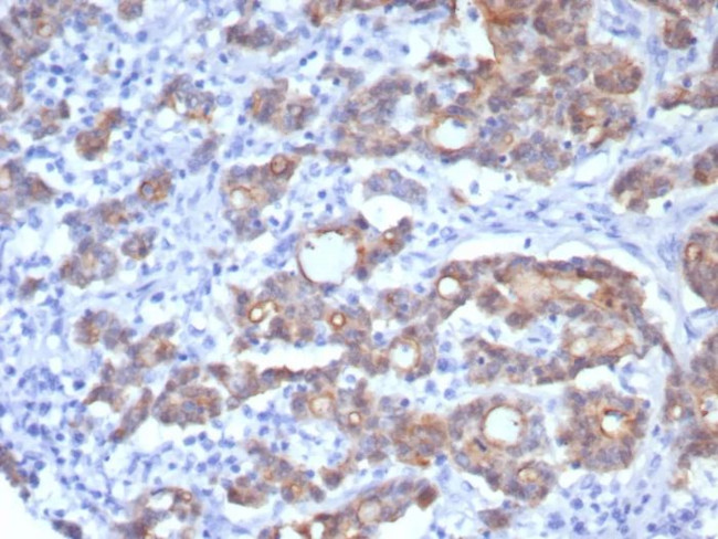 Villin (GI-Mucosal and Urogenital Brush Border Marker) Antibody in Immunohistochemistry (Paraffin) (IHC (P))