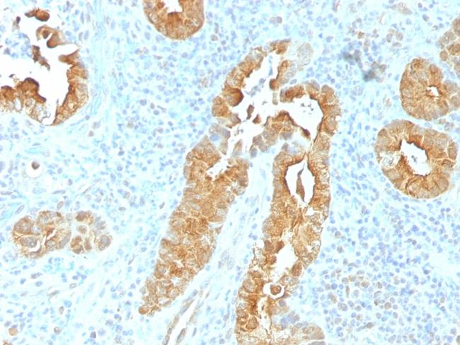 Villin (GI-Mucosal and Urogenital Brush Border Marker) Antibody in Immunohistochemistry (Paraffin) (IHC (P))