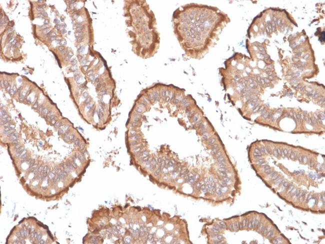 Villin (GI-Mucosal and Urogenital Brush Border Marker) Antibody in Immunohistochemistry (Paraffin) (IHC (P))