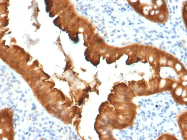 Villin (GI-Mucosal and Urogenital Brush Border Marker) Antibody in Immunohistochemistry (Paraffin) (IHC (P))