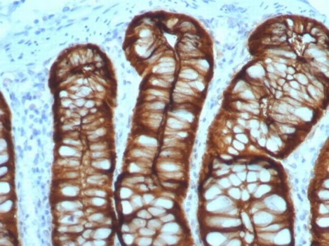 Villin (GI-Mucosal and Urogenital Brush Border Marker) Antibody in Immunohistochemistry (Paraffin) (IHC (P))