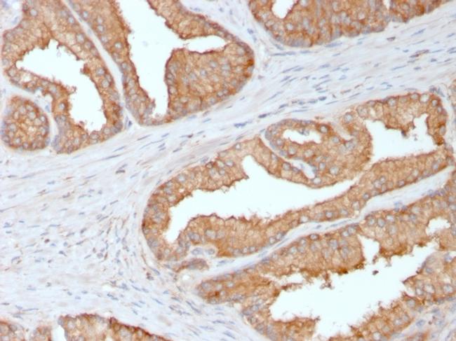 Ezrin/p81 Antibody in Immunohistochemistry (Paraffin) (IHC (P))