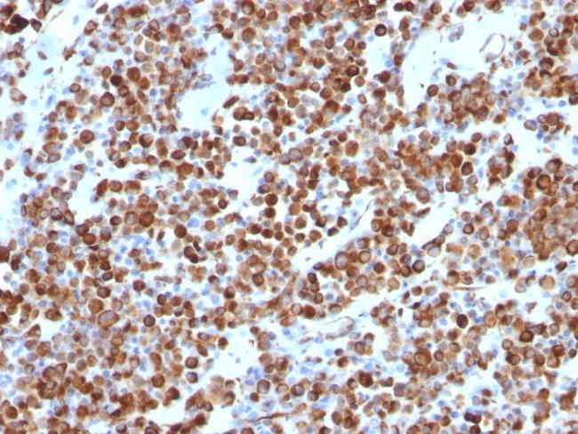 Vimentin (Mesenchymal Cell Marker) Antibody in Immunohistochemistry (Paraffin) (IHC (P))