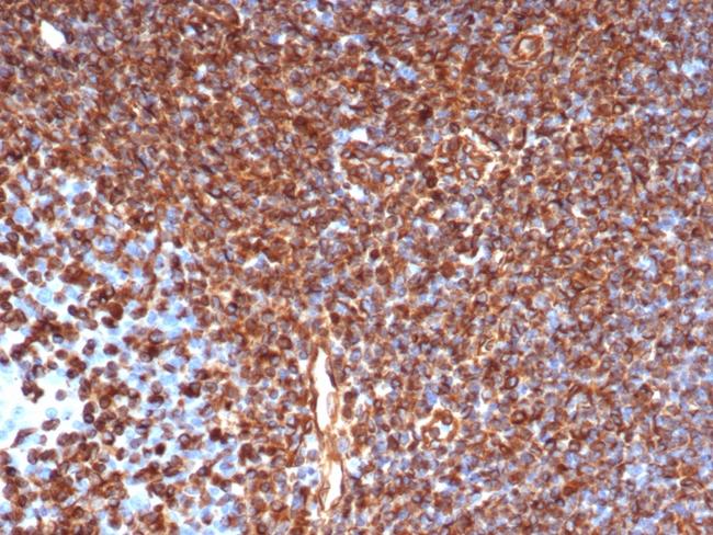 Vimentin (Mesenchymal Cell Marker) Antibody in Immunohistochemistry (Paraffin) (IHC (P))