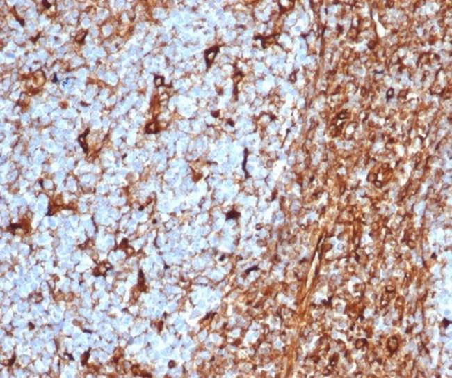 Vimentin (Mesenchymal Cell Marker) Antibody in Immunohistochemistry (Paraffin) (IHC (P))