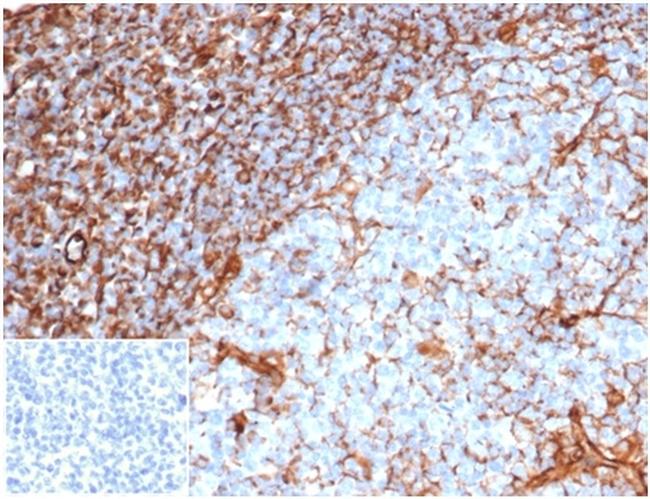 Vimentin (Mesenchymal Cell Marker) Antibody in Immunohistochemistry (Paraffin) (IHC (P))