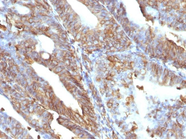 Vimentin (Mesenchymal Cell Marker) Antibody in Immunohistochemistry (Paraffin) (IHC (P))