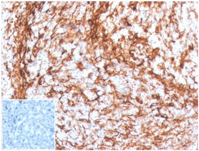 Vimentin Antibody in Immunohistochemistry (Paraffin) (IHC (P))