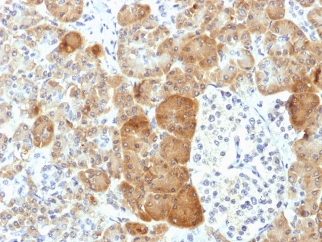 VLDL-Receptor (Very Low Density Lipoprotein Receptor) Antibody in Immunohistochemistry (Paraffin) (IHC (P))