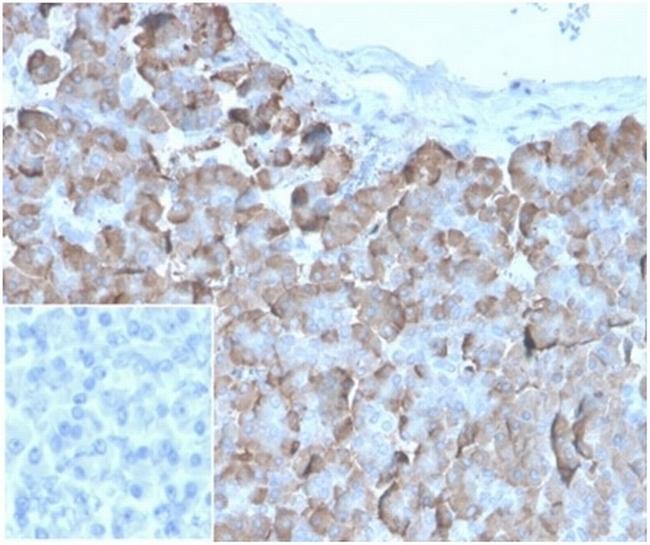 VLDL-Receptor (Very Low Density Lipoprotein Receptor) Antibody in Immunohistochemistry (Paraffin) (IHC (P))