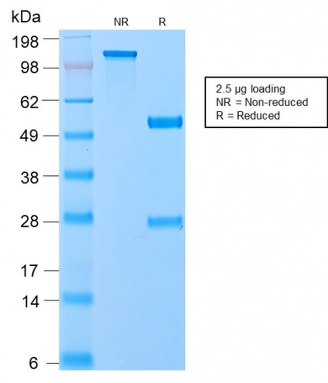 VLDL-Receptor (Very Low Density Lipoprotein Receptor) Antibody in Immunoelectrophoresis (IE)