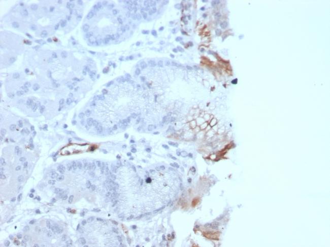 von Willebrand Factor/Factor VIII Related-Ag (Endothelial Marker) Antibody in Immunohistochemistry (Paraffin) (IHC (P))