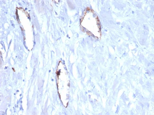 von Willebrand Factor/Factor VIII Related-Ag (Endothelial Marker) Antibody in Immunohistochemistry (Paraffin) (IHC (P))