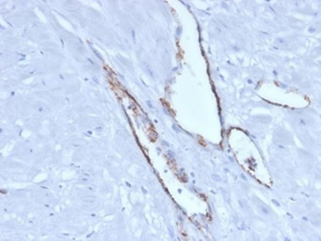 von Willebrand Factor/Factor VIII Related-Ag (Endothelial Marker) Antibody in Immunohistochemistry (Paraffin) (IHC (P))