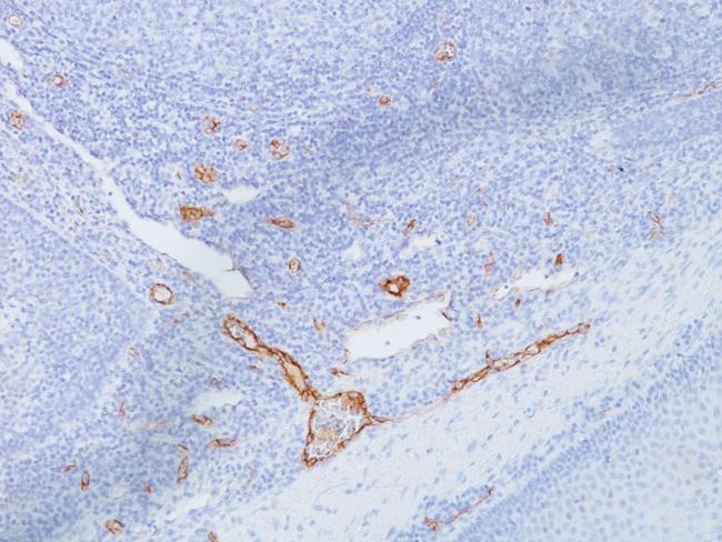 von Willebrand Factor/Factor VIII Related-Ag (Endothelial Marker) Antibody in Immunohistochemistry (Paraffin) (IHC (P))