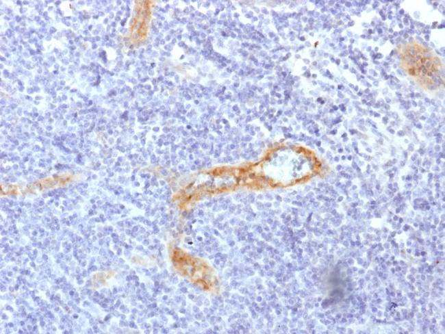 von Willebrand Factor/Factor VIII Related-Ag (Endothelial Marker) Antibody in Immunohistochemistry (Paraffin) (IHC (P))