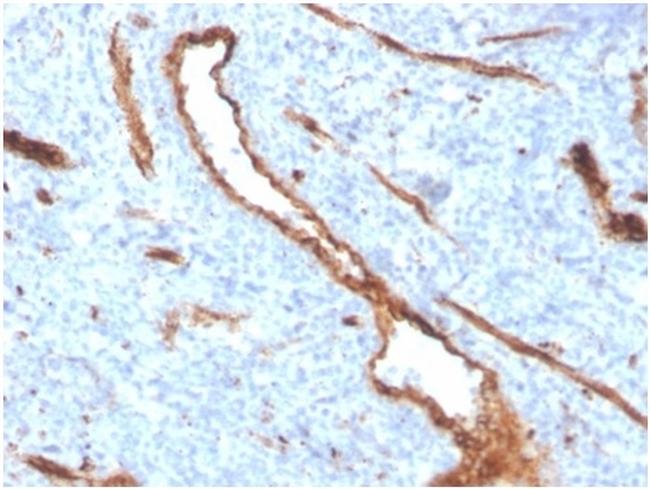 von Willebrand Factor/Factor VIII Related-Ag (Endothelial Marker) Antibody in Immunohistochemistry (Paraffin) (IHC (P))