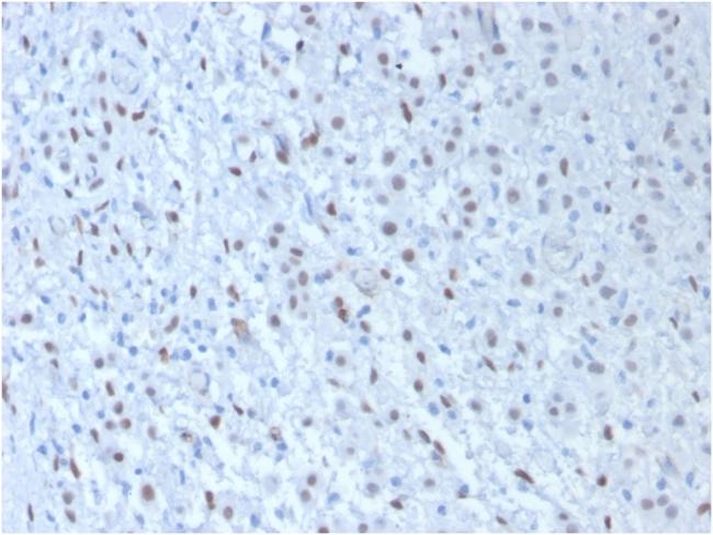 Wilm's Tumor 1 (WT1) (Wilm's Tumor and Mesothelial Marker) Antibody in Immunohistochemistry (Paraffin) (IHC (P))