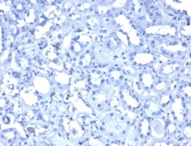 Wilms Tumor 1 (WT1) Antibody in Immunohistochemistry (Paraffin) (IHC (P))