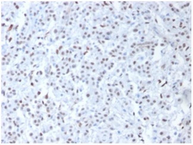 Wilm's Tumor 1 (WT1) (Wilm's Tumor and Mesothelial Marker) Antibody in Immunohistochemistry (Paraffin) (IHC (P))