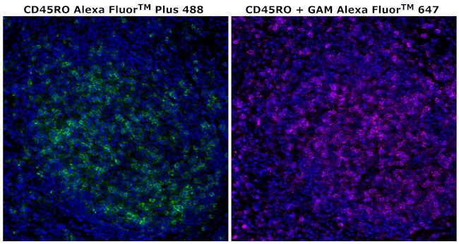 CD45RO Antibody in Immunohistochemistry (Paraffin) (IHC (P))