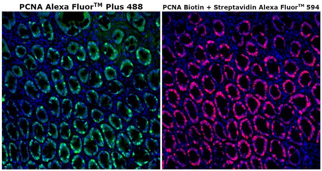 PCNA Antibody in Immunohistochemistry (Paraffin) (IHC (P))