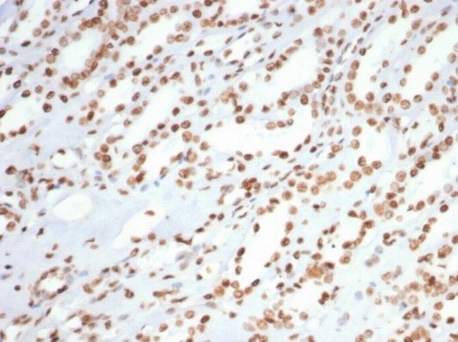 XRCC5 (Ku86/Ku80) (Thyroid-Lupus Autoantigen) Antibody in Immunohistochemistry (Paraffin) (IHC (P))