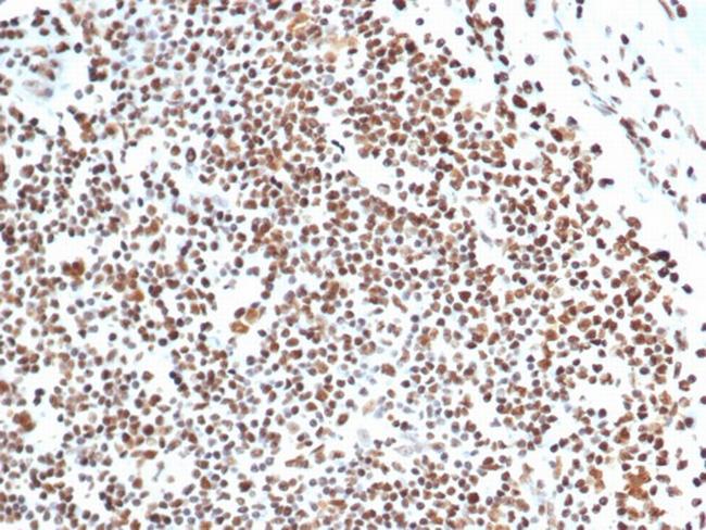 XRCC5 (Ku86/Ku80) (Thyroid-Lupus Autoantigen) Antibody in Immunohistochemistry (Paraffin) (IHC (P))