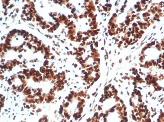 XRCC5 (Ku86/Ku80) (Thyroid-Lupus Autoantigen) Antibody in Immunohistochemistry (Paraffin) (IHC (P))