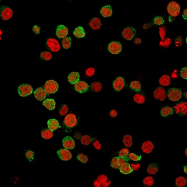 ZAP70 (Chronic Lymphocytic Leukemia Marker) Antibody in Immunocytochemistry (ICC/IF)