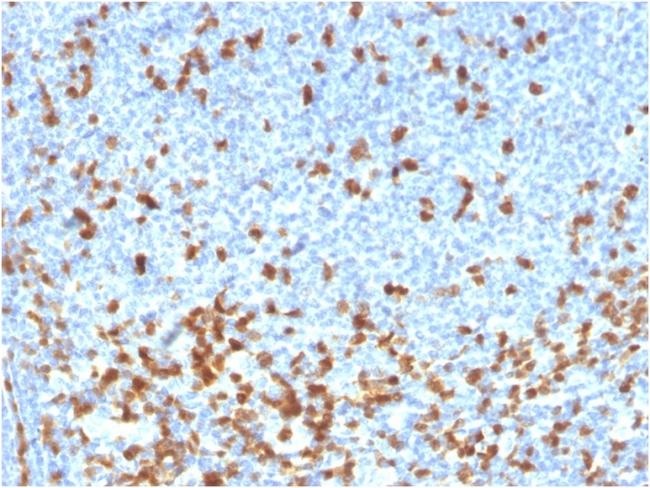 ZAP70 (Chronic Lymphocytic Leukemia Marker) Antibody in Immunohistochemistry (Paraffin) (IHC (P))