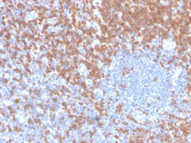 ZAP70 (Chronic Lymphocytic Leukemia Marker) Antibody in Immunohistochemistry (Paraffin) (IHC (P))