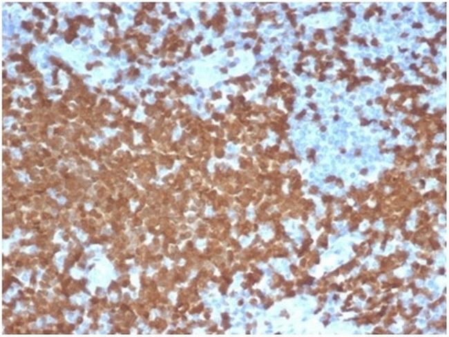 ZAP70 (Chronic Lymphocytic Leukemia Marker) Antibody in Immunohistochemistry (Paraffin) (IHC (P))