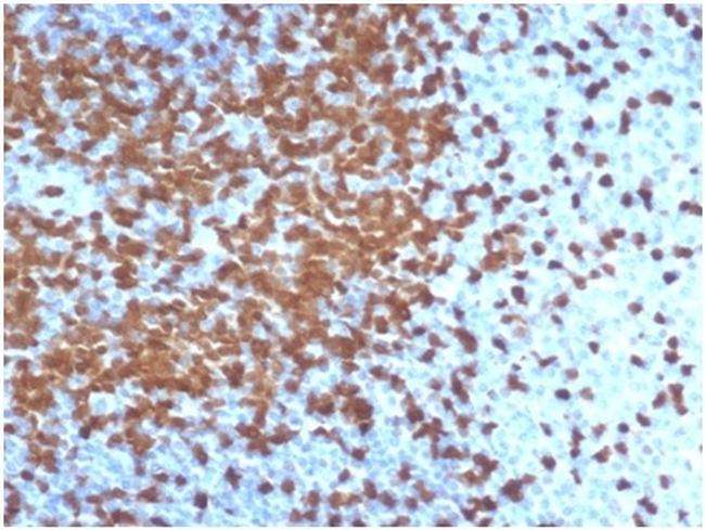 ZAP70 (Chronic Lymphocytic Leukemia Marker) Antibody in Immunohistochemistry (Paraffin) (IHC (P))