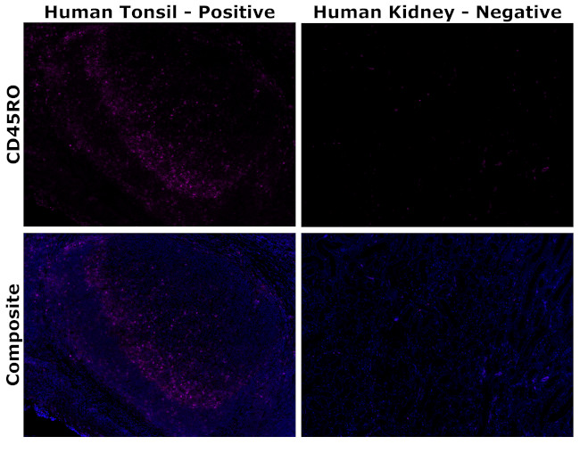 CD45RO Antibody in Immunohistochemistry (Paraffin) (IHC (P))