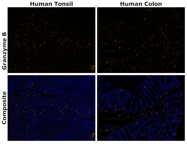 Granzyme B Antibody in Immunohistochemistry (Paraffin) (IHC (P))